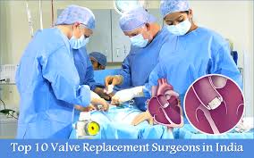 Best Heart Valve Repair Surgeons of India