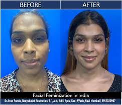 Facial Feminization Surgery in Mumbai – Dr. Arun Panda