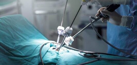 Minimal Access Surgery: Revolutionizing Patient Care