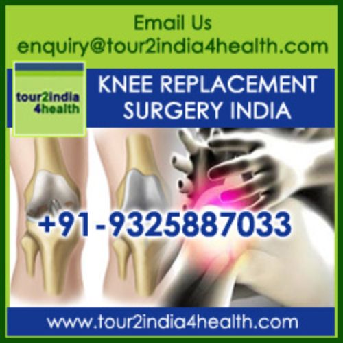 Average cost of knee replacement