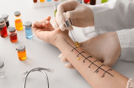 Allergy Specialist in Dubai: Treatment Options