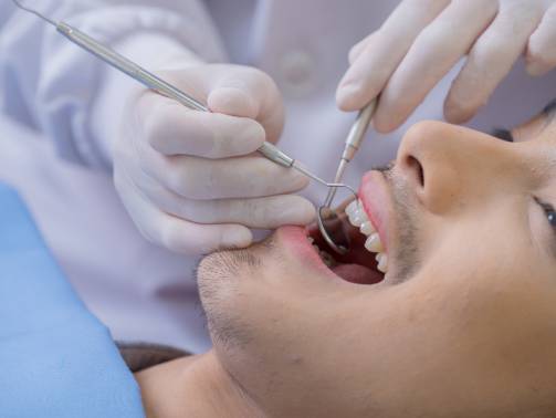 Wisdom Teeth Pain? Here’s When to See a Dentist