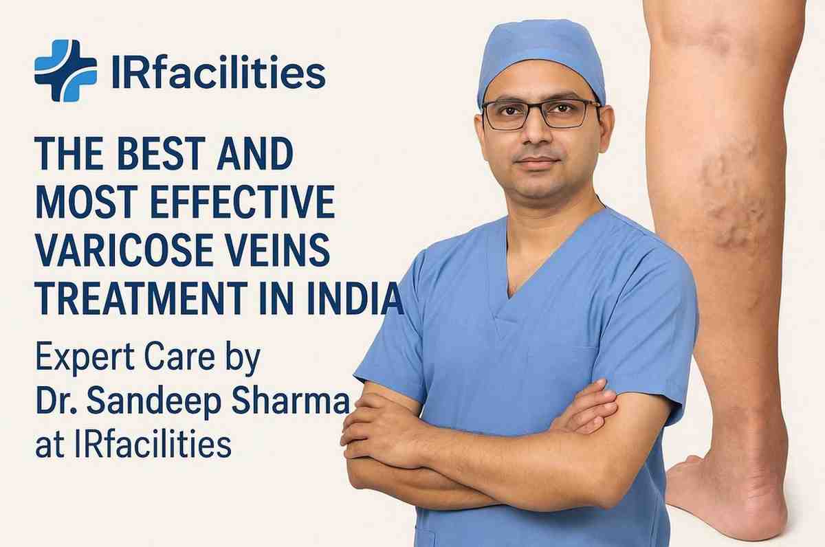 Best Varicose Veins Treatment in India