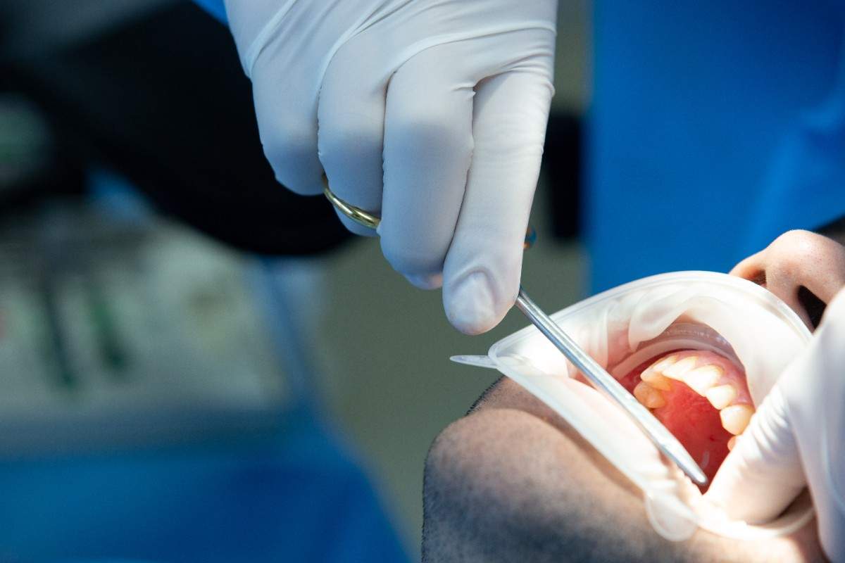 How a Root Canal Specialist Georgetown Simplifies Care