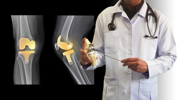 Joint Replacement Surgeon for Advanced Orthopedic Care