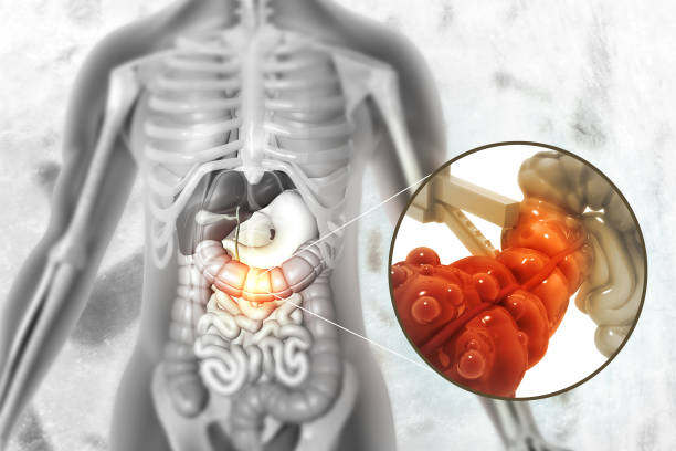 Appendix Surgery in Jaipur: Complete Guide to Symptoms