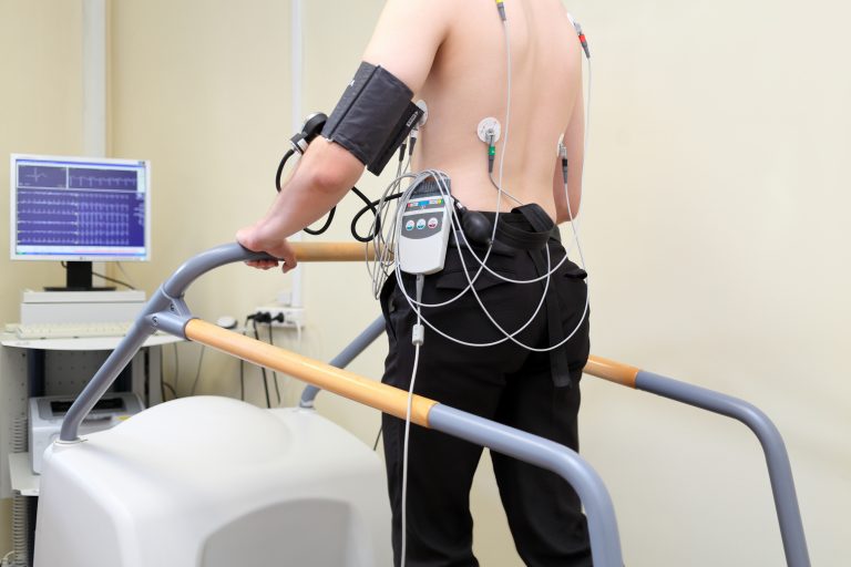 Treadmill Test Near Me –Benefits & Procedure