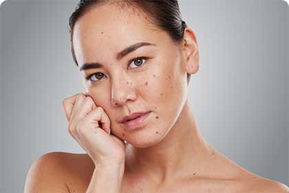 What to Know About Laser Hair Removal for Smooth