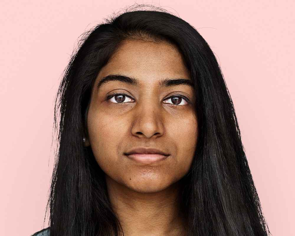 Why Face Pigmentation Keeps Coming Back