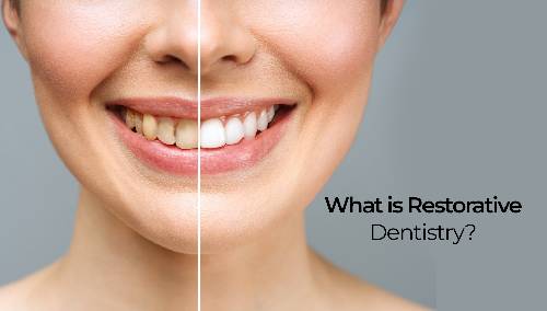 What Is Restorative Dentistry