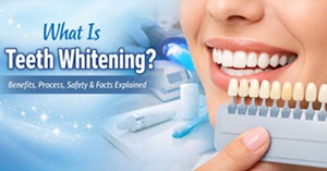What is Teeth Whitening? Benefits & Process Explained