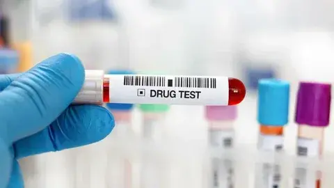 Drug Testing Fundamentals Everyone Should Understand