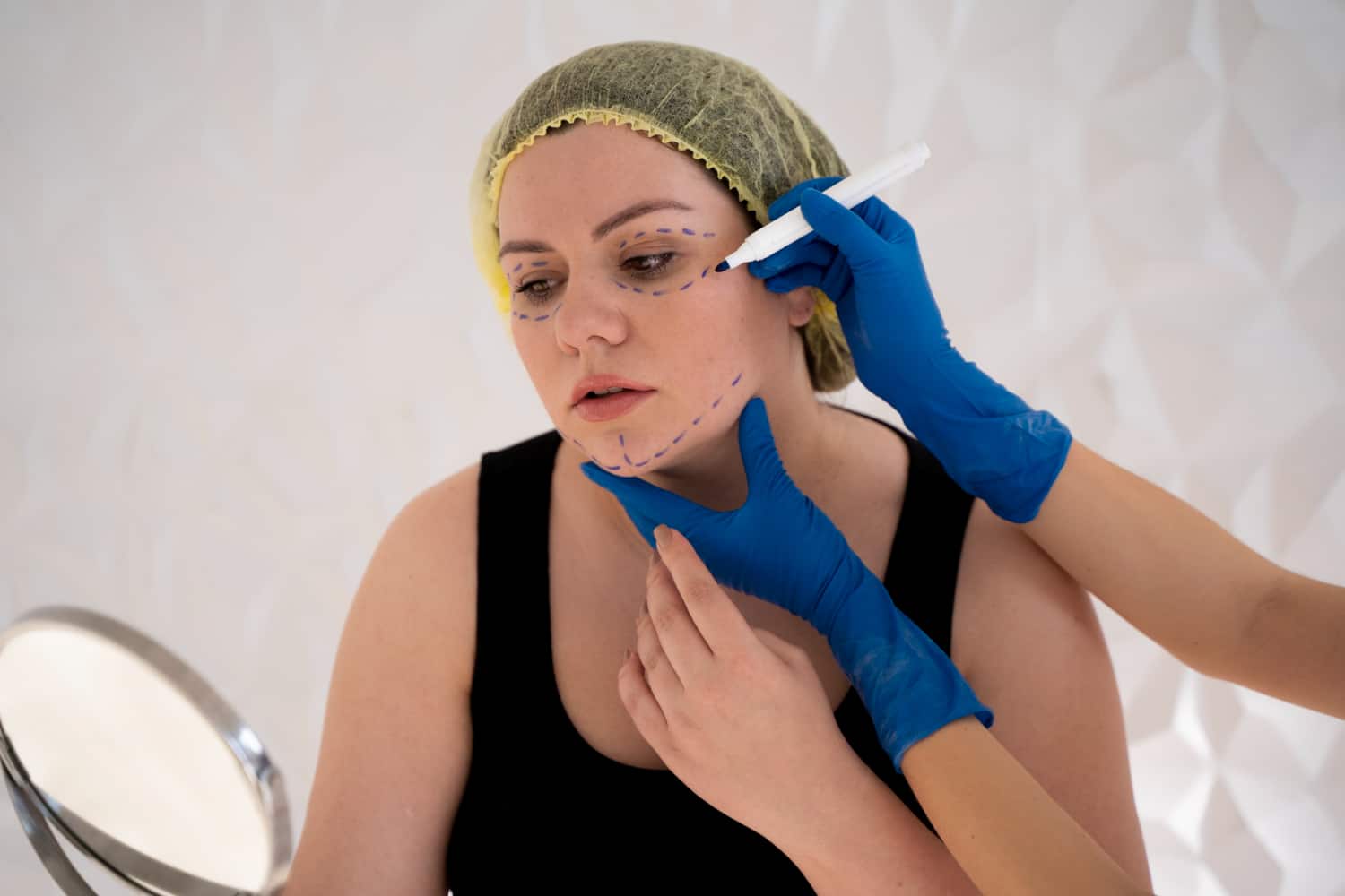 BBL Skin Therapy: Advanced Light Technology for Clear