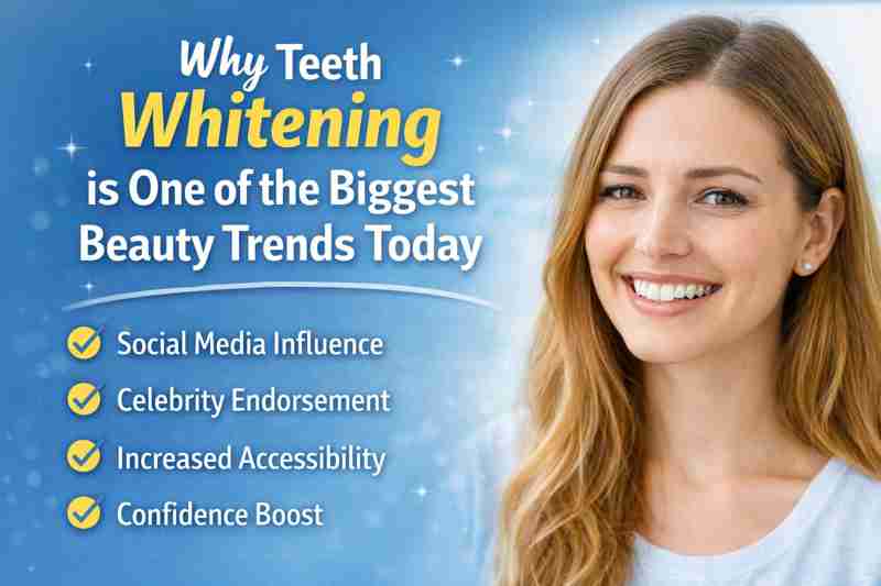 Why Teeth Whitening Is One of the Biggest Beauty Trends