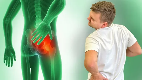 How Athletes Manage Sciatica and Nerve Pain