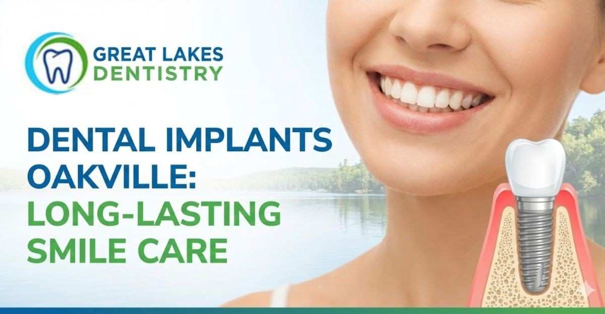 Dental Implants Oakville: Long-Lasting Smile Care