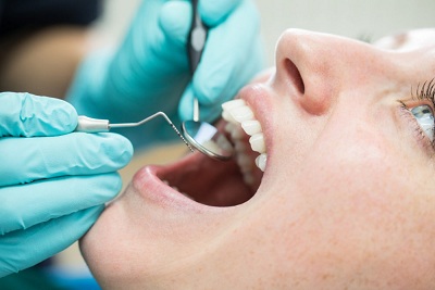 How to Choose a Quality Dentist Without Overspending?