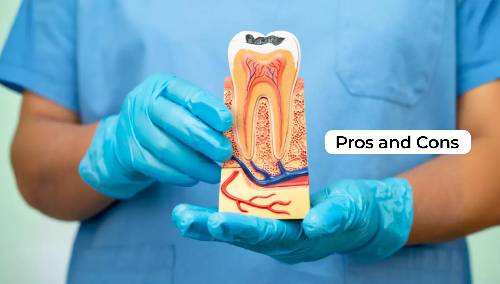Root Canal Treatment Pros and Cons Explained