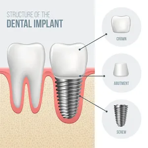 Dental Treatment in Turkey: UK Patient Guide