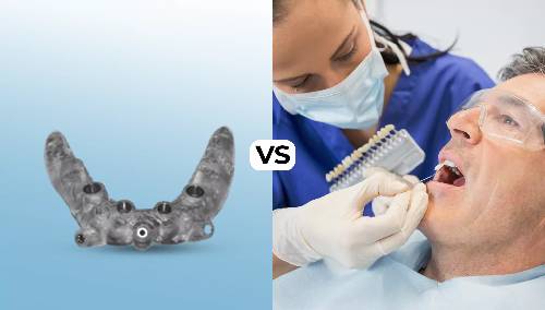 Guided vs. Non-Guided Dental Implant Surgery