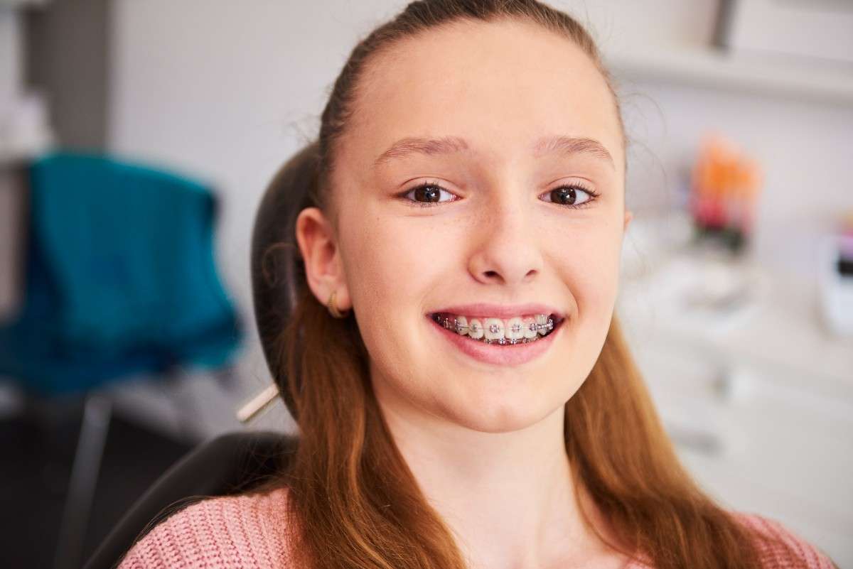 Orthodontist in Milton for Smile Correction Benefits