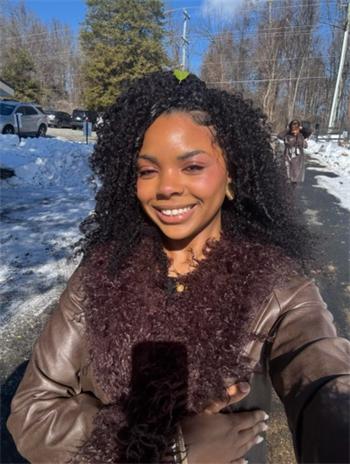 The Ultimate Guide to Scalp Care While Wearing Wigs
