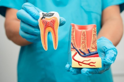 What to Expect From a Root Canal Specialist Georgetown