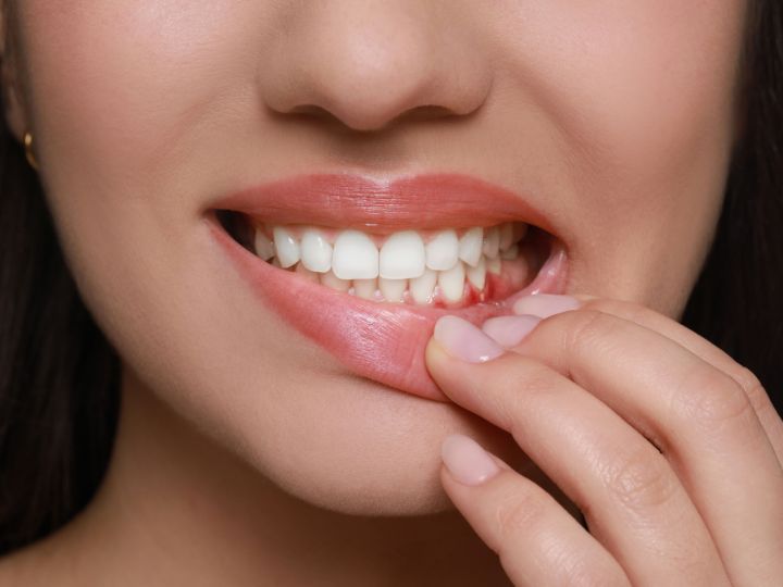 Common Mistakes That Make a Hole in Gum Worse