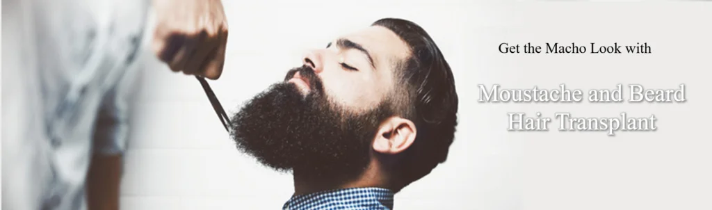 Beard Hair Transplant in Ahmedabad Guide