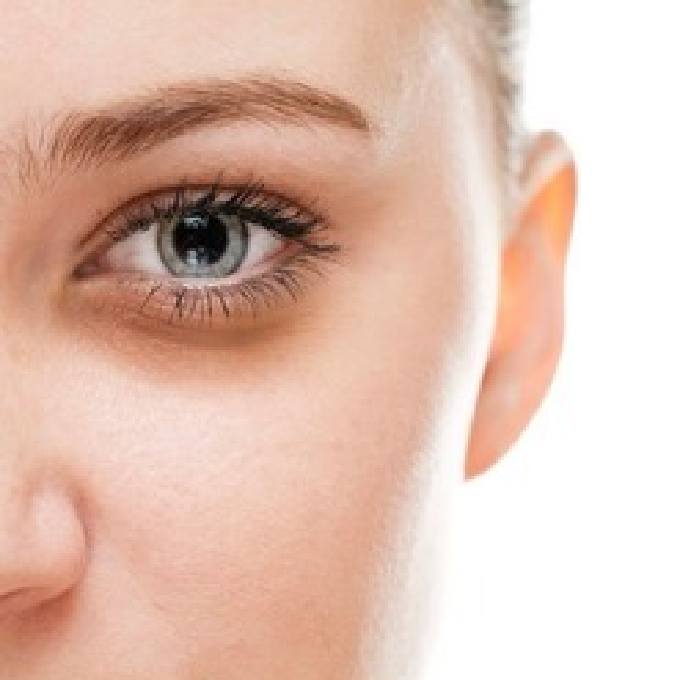 Professional Skin Experts for Dark Circles Treatment