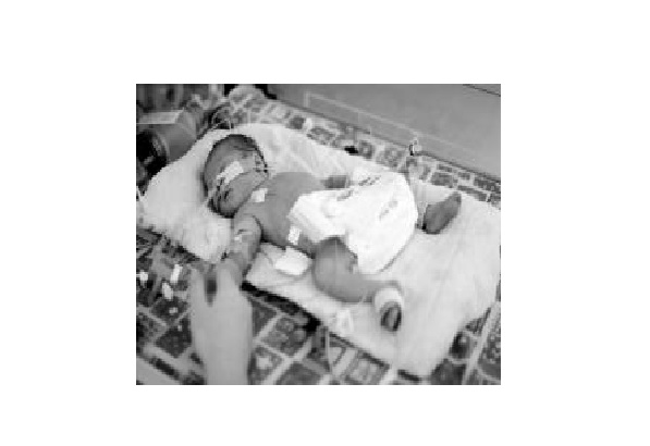 Do You Need A Birth Injury Lawyer In Boston