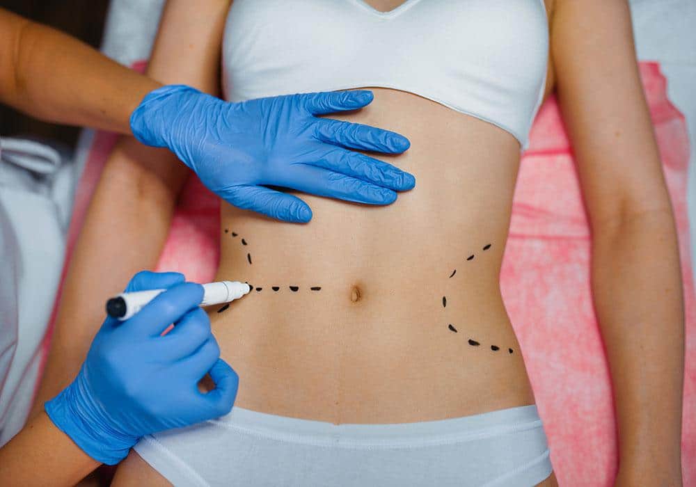 Long-Term Benefits of Bariatric Surgery in Islamabad