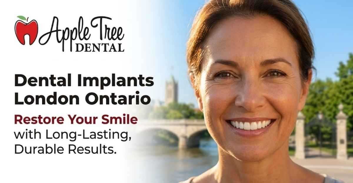 Dental Implants London Ontario: Restore Your Smile