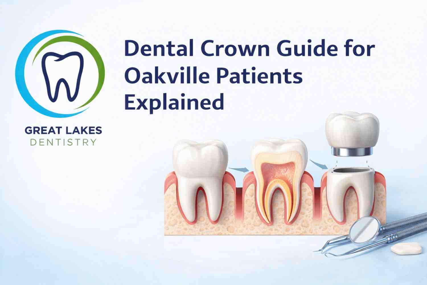 Dental Crown Guide for Oakville Patients Explained