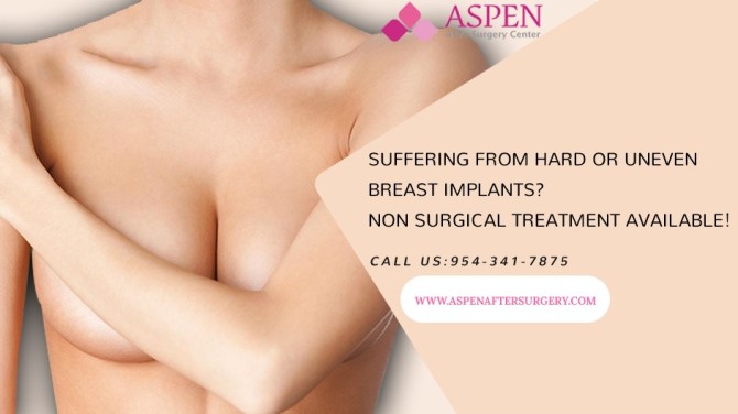 When Should You Take Free Breast Implant Problems Test