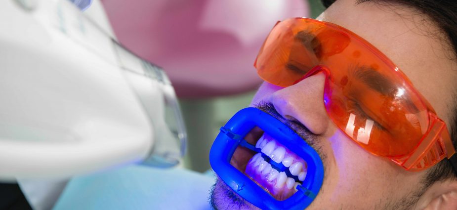 Top Benefits of Professional Teeth Whitening Treatments