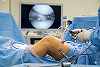 When Can You Walk After Knee Arthroscopy?
