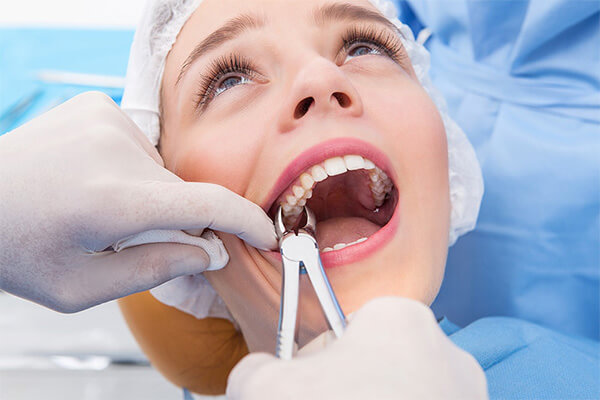Your Guide to Getting Dental Crowns in Cudahy