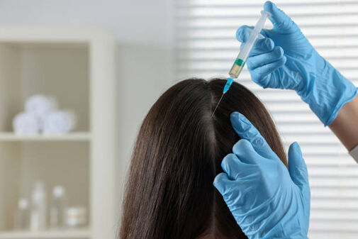 Mesotherapy  Benefits, Procedure, and Results