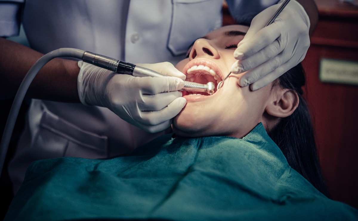 Veneers vs Bonding for Smile Makeovers