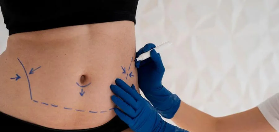 Laparoscopic Surgery in Islamabad