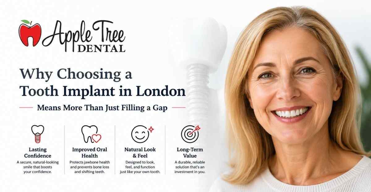 Why Choosing a Tooth Implant in London