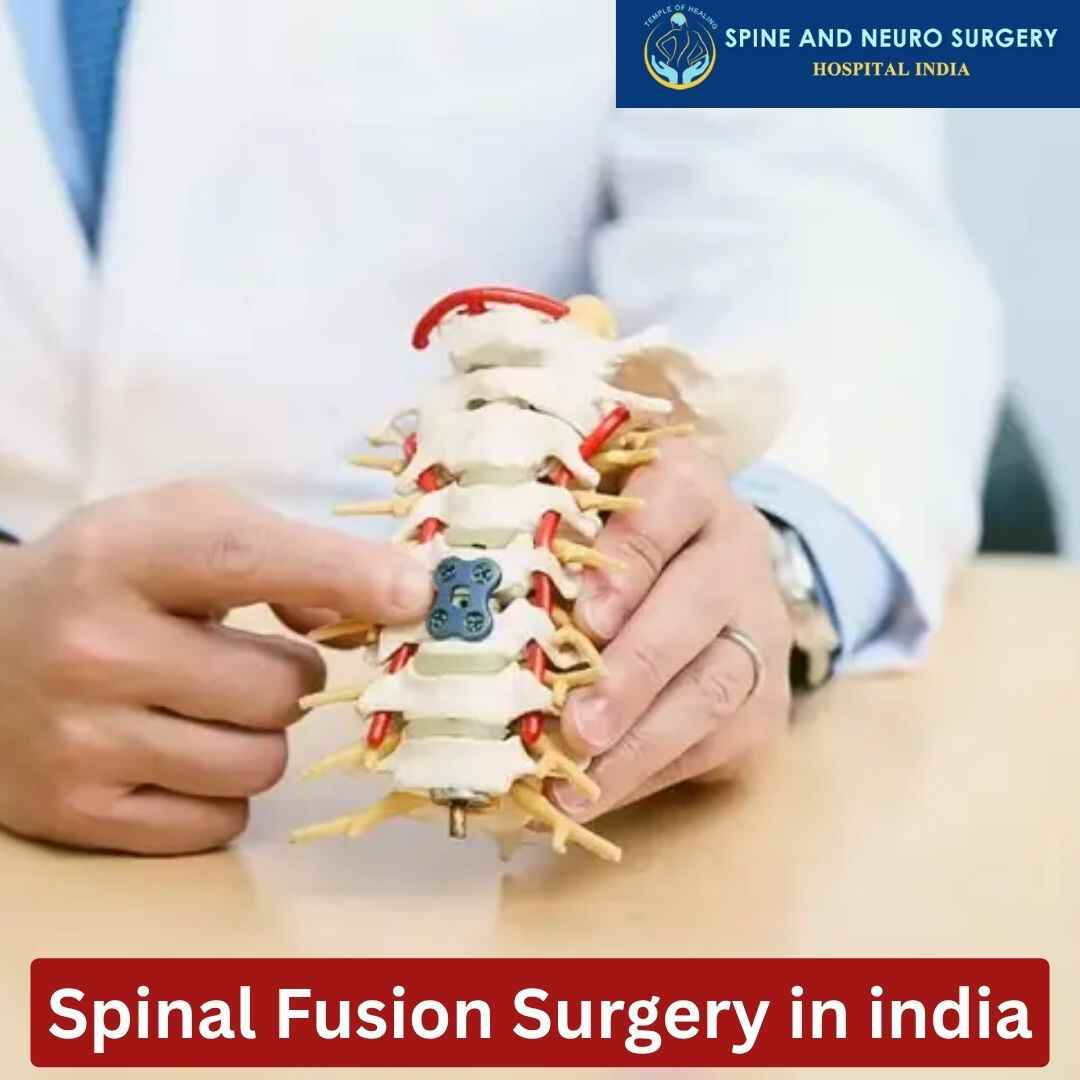 Spinal Fusion Surgery in india