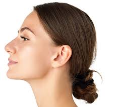 Ear Surgery in Dubai
