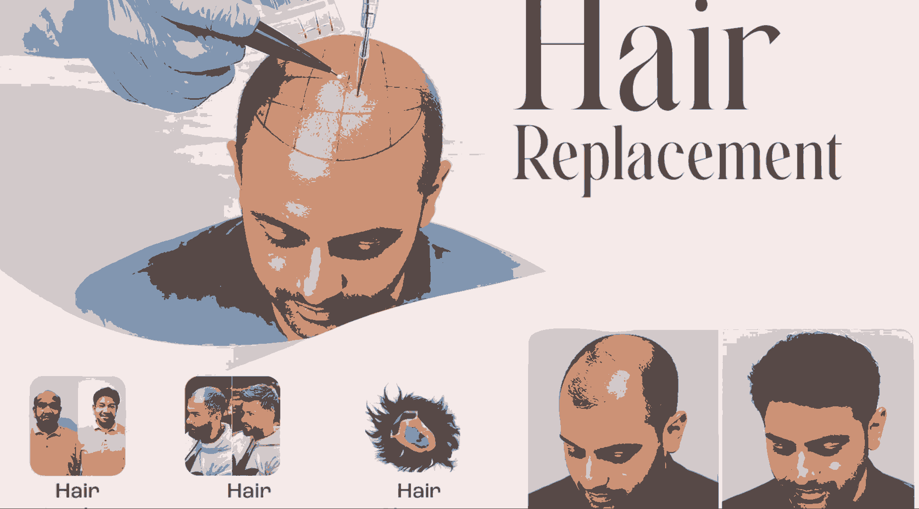Hair Patch in Jaipur – Natural Hair Solutions