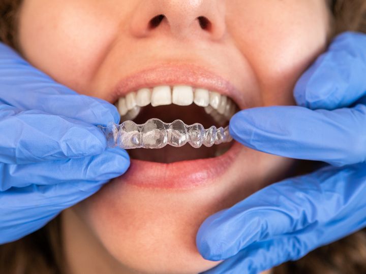 What Happens If You Stop Wearing Your Teeth Retainer?