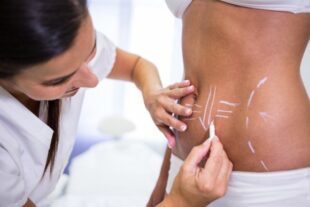 Enhancing Natural Shape and Definition