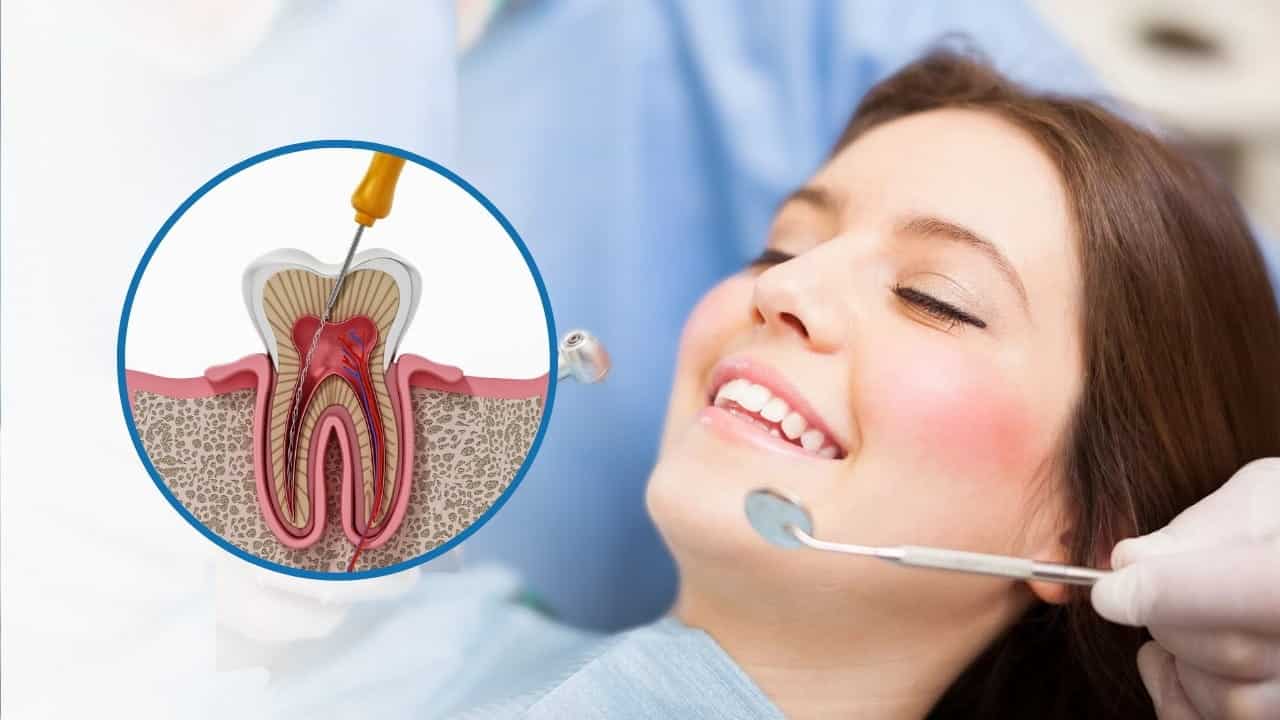 Wisdom Tooth Removal in Electronic City