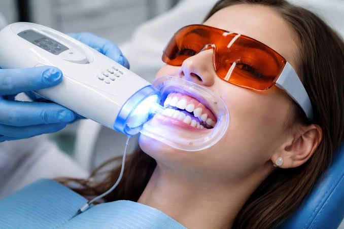 Teeth Whitening Services in Tenali for a Brighter Smile