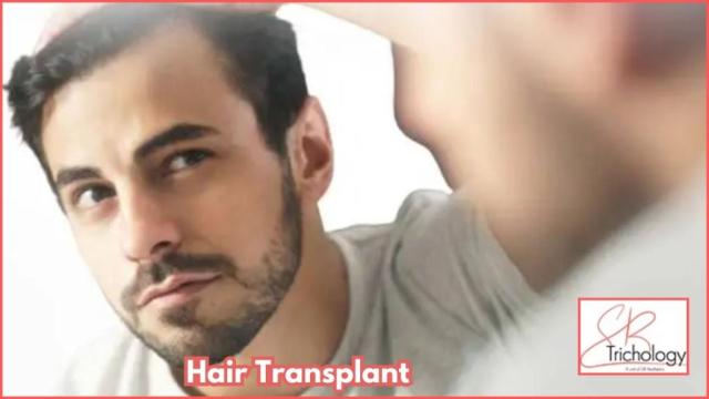 Best Clinic For Hair Transplant in Gurgaon – SB Trichology